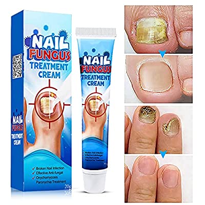 Nail Repair Cream