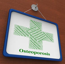 Forteo Osteoporosis