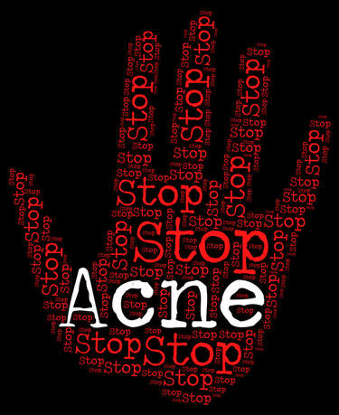 best way to get rid of acne